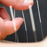 Sense Podiatry - Dry Needling